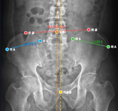 X-ray 기준점 AI